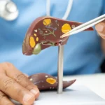 Doktor-zeigt-eine-leber